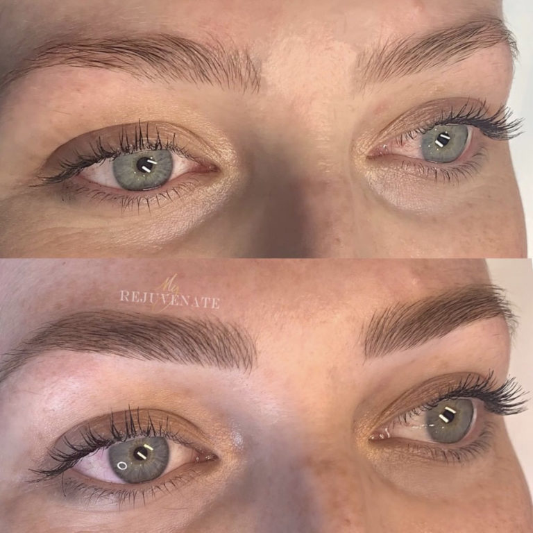 My-Rejuvenate-Microblading
