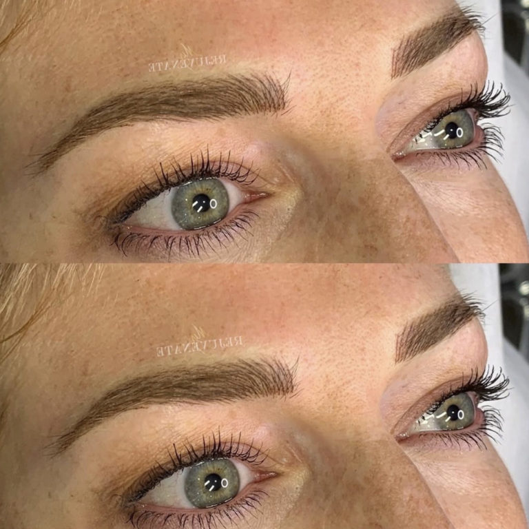 My-Rejuvenate-Nano feathering