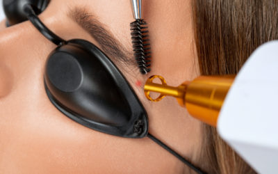 Understanding Cosmetic Tattoo Removal in Sydney: Safe, Modern Solutions for Clearer Skin